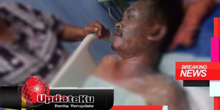 Insiden : 80 Persen Luka Bakar, Warga Jambi ini Butuh Uluran Tangan Dermawan